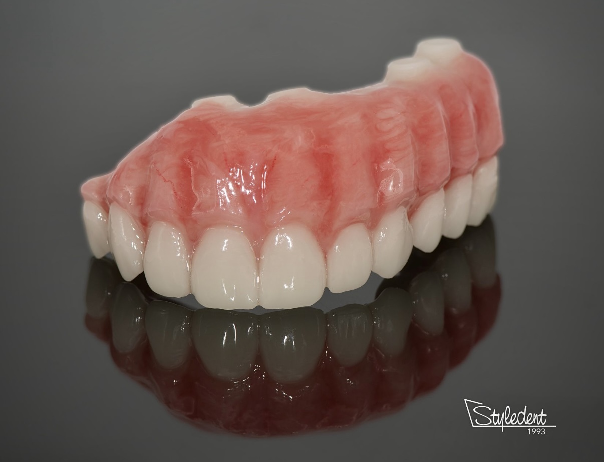 Using Temporaries to Perfect Esthetics and Occlusion in Dental Restorations